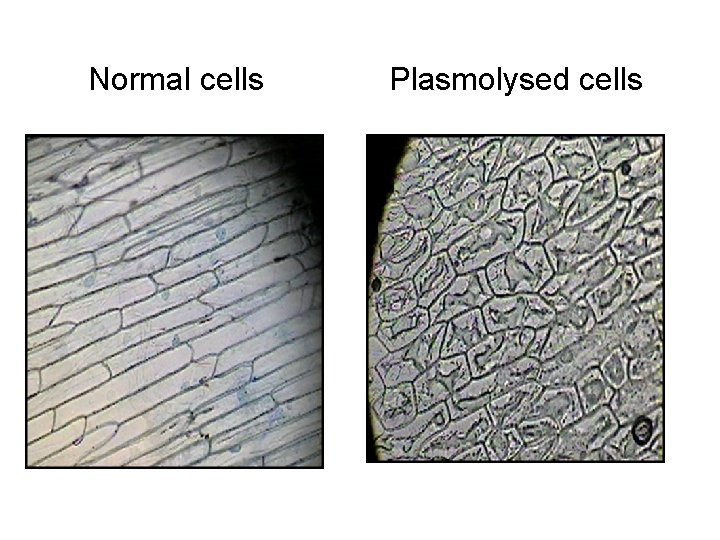 Normal cells Plasmolysed cells 