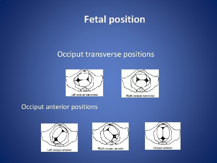 Fetal position Occiput transverse positions Occiput anterior positions 