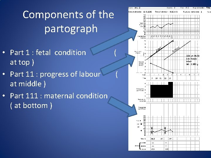 Components of the partograph • Part 1 : fetal condition ( at top )