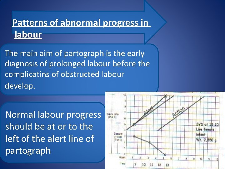 Patterns of abnormal progress in labour The main aim of partograph is the early