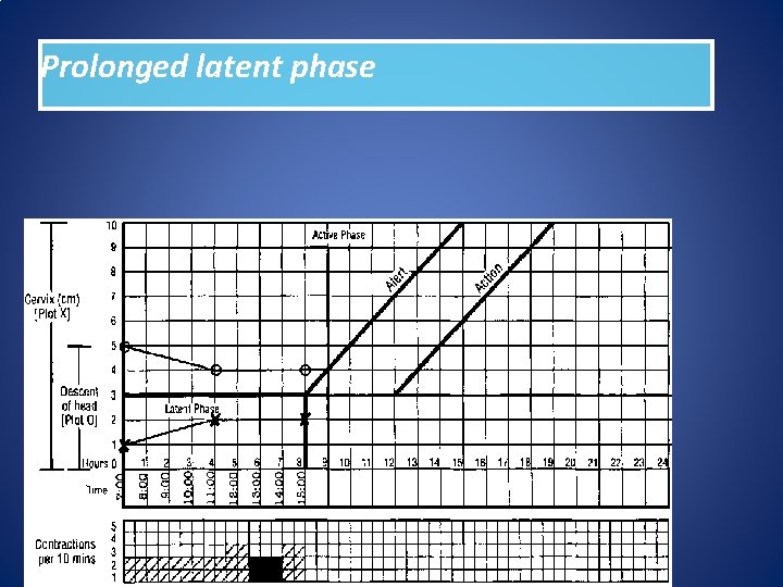 Prolonged labour Dr ban hadi Abnormal labour by