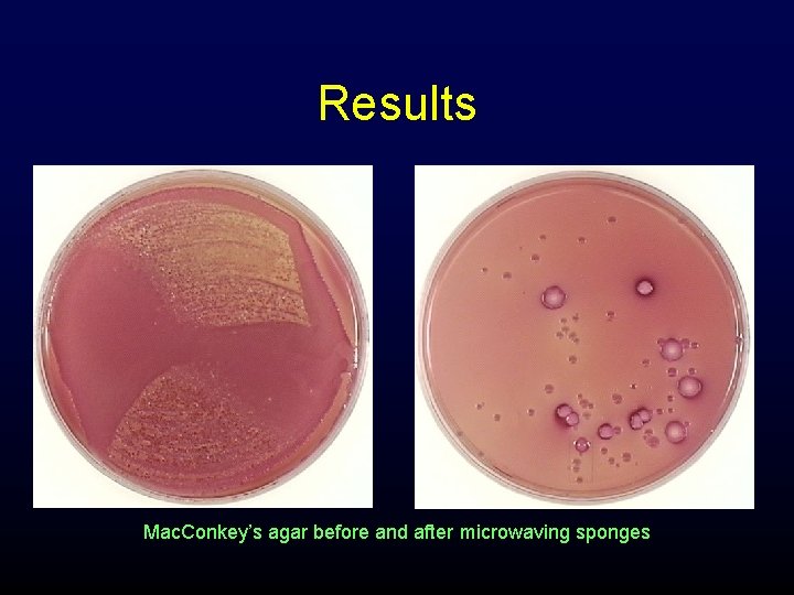 Results Mac. Conkey’s agar before and after microwaving sponges 