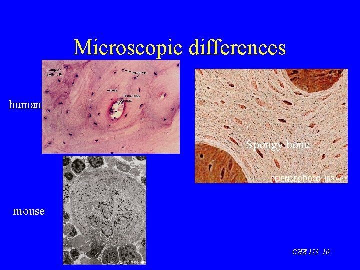 Microscopic differences human Spongy bone mouse CHE 113 10 