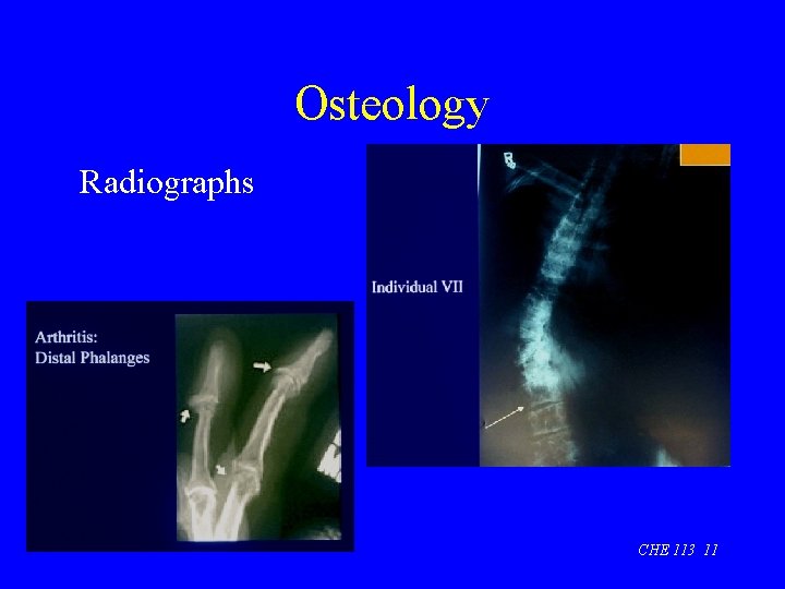 Osteology Radiographs CHE 113 11 