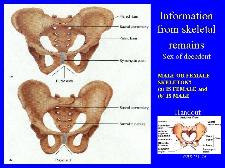 Information from skeletal remains Sex of decedent MALE OR FEMALE SKELETON? (a) IS FEMALE