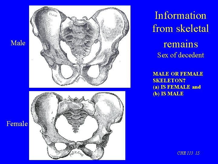 Male Information from skeletal remains Sex of decedent MALE OR FEMALE SKELETON? (a) IS
