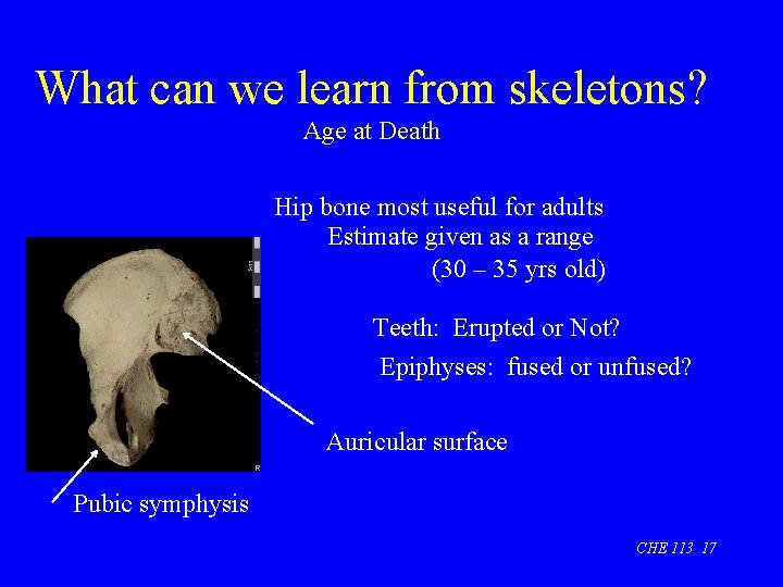 What can we learn from skeletons? Age at Death Hip bone most useful for