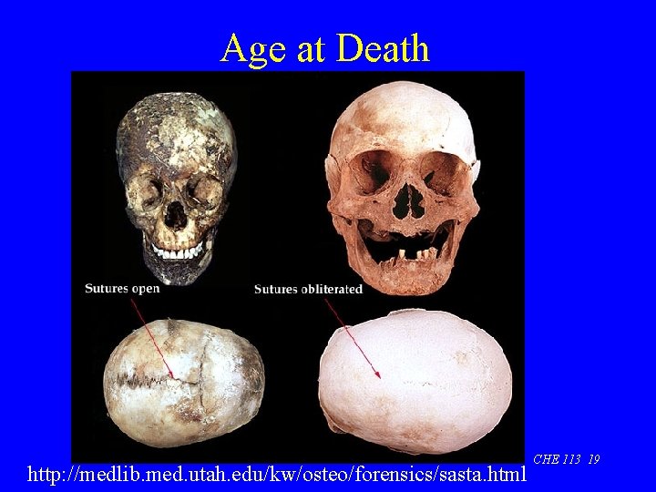 Age at Death http: //medlib. med. utah. edu/kw/osteo/forensics/sasta. html CHE 113 19 