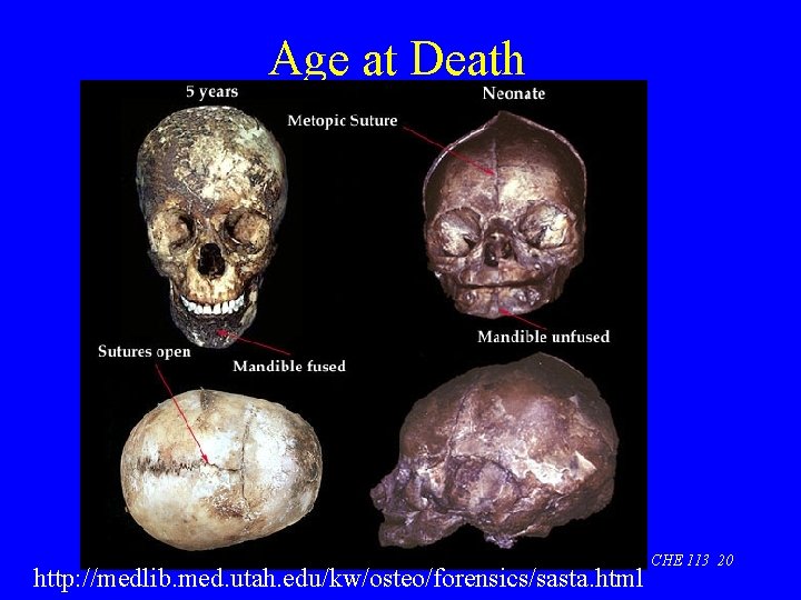 Age at Death http: //medlib. med. utah. edu/kw/osteo/forensics/sasta. html CHE 113 20 