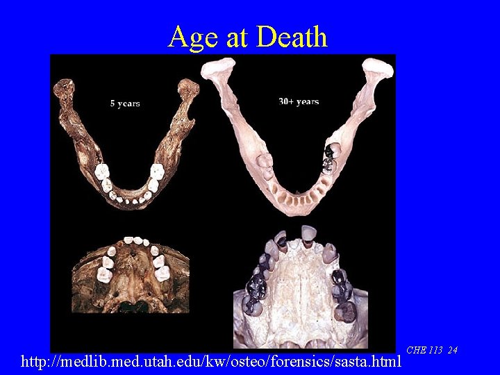 Age at Death http: //medlib. med. utah. edu/kw/osteo/forensics/sasta. html CHE 113 24 