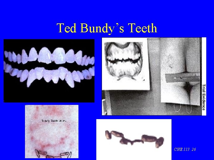 Ted Bundy’s Teeth CHE 113 26 