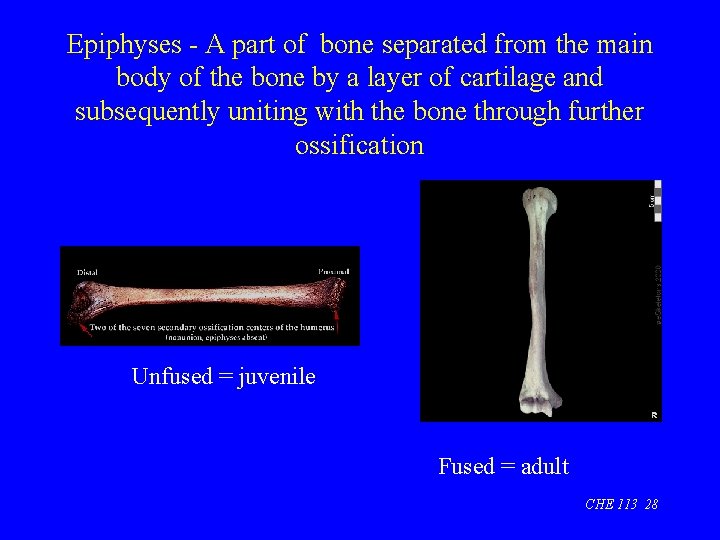Epiphyses - A part of bone separated from the main body of the bone