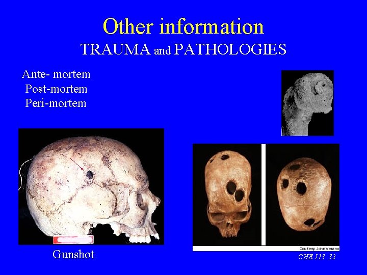 Other information TRAUMA and PATHOLOGIES Ante- mortem Post-mortem Peri-mortem Gunshot CHE 113 32 
