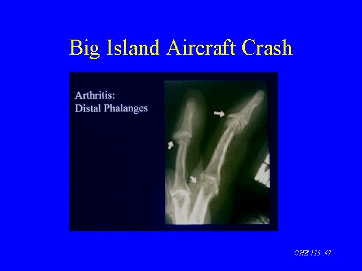 Big Island Aircraft Crash CHE 113 47 