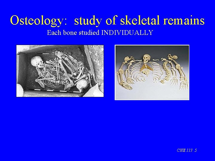 Osteology: study of skeletal remains Each bone studied INDIVIDUALLY CHE 113 5 