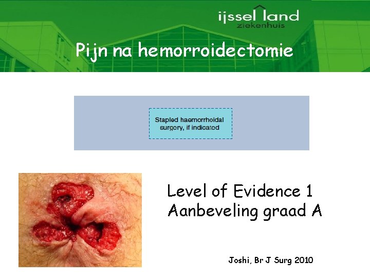 Pijn na hemorroidectomie Level of Evidence 1 Aanbeveling graad A Joshi, Br J Surg