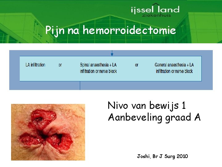 Pijn na hemorroidectomie Nivo van bewijs 1 Aanbeveling graad A Joshi, Br J Surg