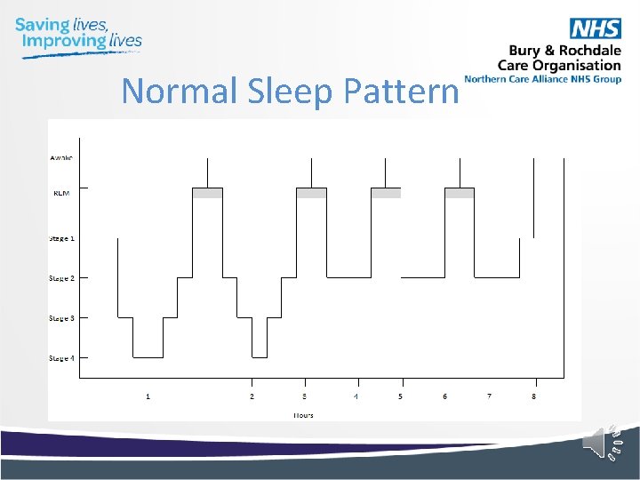Normal Sleep Pattern Normal Sleep Pattern