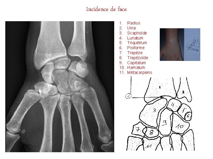 Incidence de face 1. 2. 3. 4. 5. 6. 7. 8. 9. 10. 11.