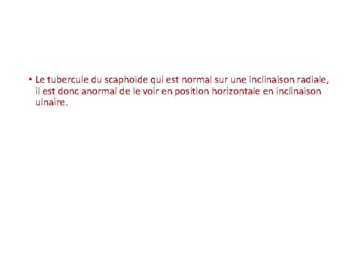  • Le tubercule du scaphoïde qui est normal sur une inclinaison radiale, il