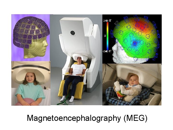 Magnetoencephalography (MEG) 