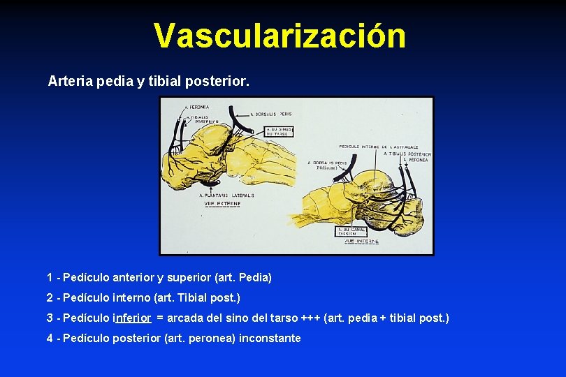 Vascularización Arteria pedia y tibial posterior. 1 - Pedículo anterior y superior (art. Pedia)