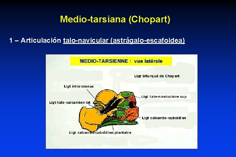 Medio-tarsiana (Chopart) 1 – Articulación talo-navicular (astrágalo-escafoidea) 
