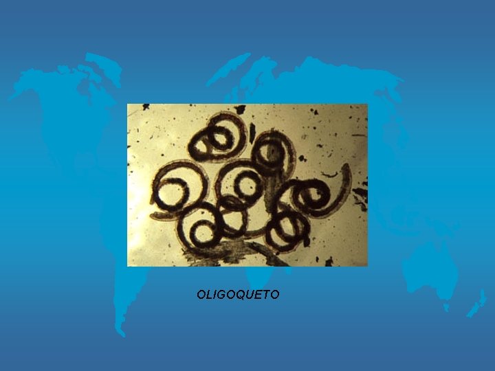 OLIGOQUETO 
