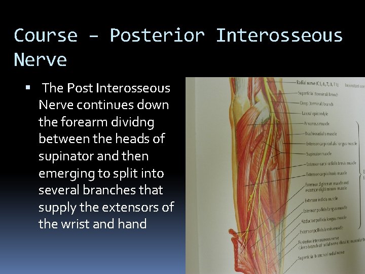 Course – Posterior Interosseous Nerve The Post Interosseous Nerve continues down the forearm dividng