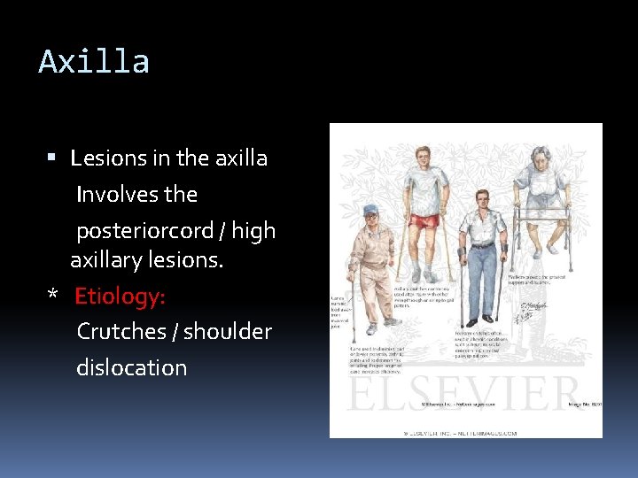 Axilla Lesions in the axilla Involves the posteriorcord / high axillary lesions. * Etiology: