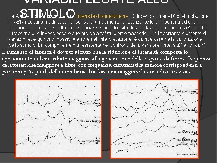  VARIABILI LEGATE ALLO STIMOLO Le ABR sono condizionate dall’ intensità di stimolazione. Riducendo