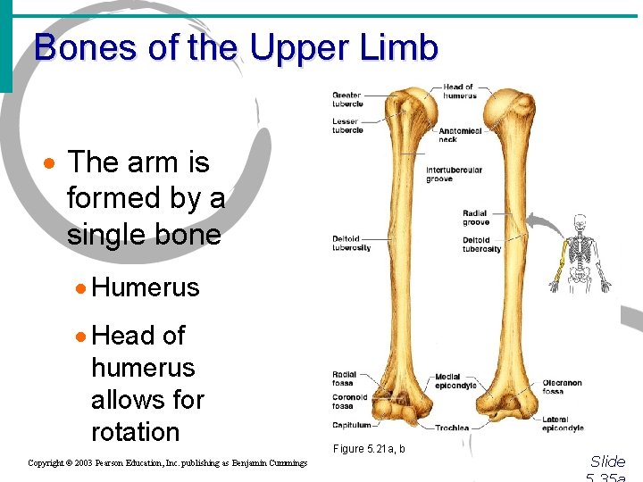 Bones of the Upper Limb · The arm is formed by a single bone