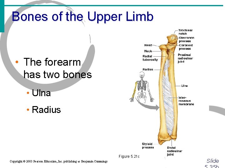 Bones of the Upper Limb • The forearm has two bones • Ulna •