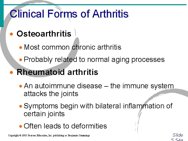 Clinical Forms of Arthritis · Osteoarthritis · Most common chronic arthritis · Probably related