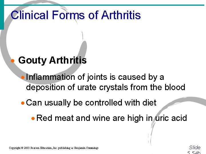 Clinical Forms of Arthritis · Gouty Arthritis · Inflammation of joints is caused by