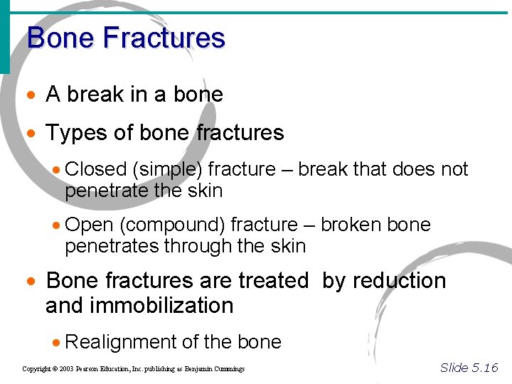 Bone Fractures · A break in a bone · Types of bone fractures ·