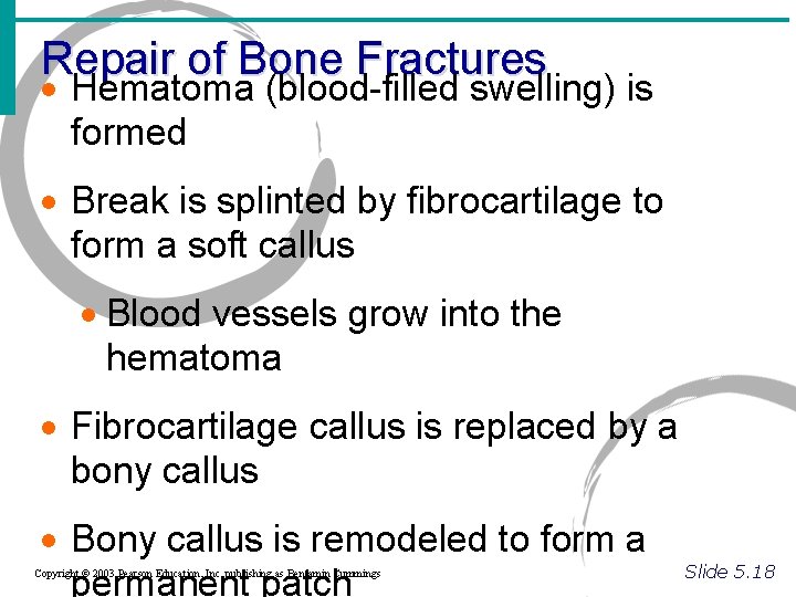 Repair of Bone Fractures · Hematoma (blood-filled swelling) is formed · Break is splinted