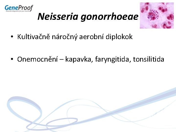 Neisseria gonorrhoeae • Kultivačně náročný aerobní diplokok • Onemocnění – kapavka, faryngitida, tonsilitida 