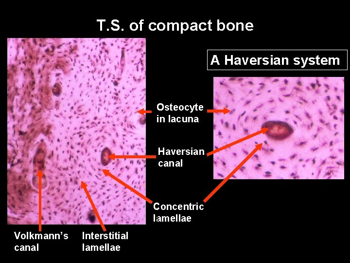 T. S. of compact bone A Haversian system Osteocyte in lacuna Haversian canal Concentric T. S. of compact bone A Haversian system Osteocyte in lacuna Haversian canal Concentric
