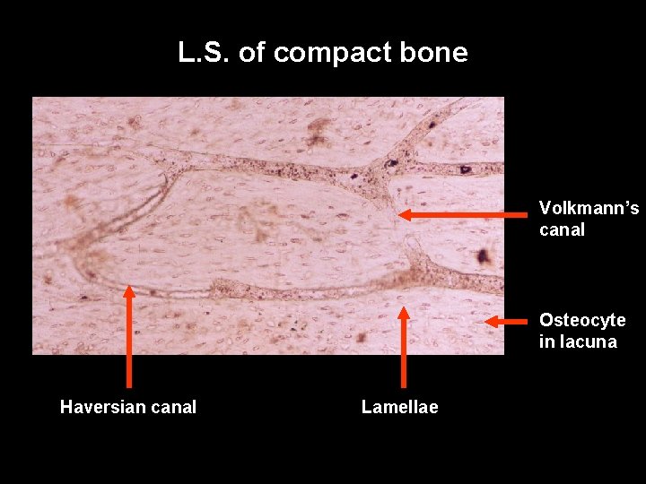 L. S. of compact bone Volkmann’s canal Osteocyte in lacuna Haversian canal Lamellae L. S. of compact bone Volkmann’s canal Osteocyte in lacuna Haversian canal Lamellae