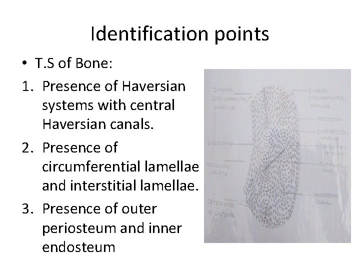 Identification points • T. S of Bone: 1. Presence of Haversian systems with central