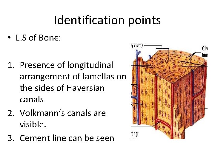 Identification points • L. S of Bone: 1. Presence of longitudinal arrangement of lamellas