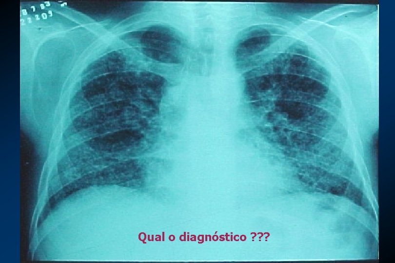 Qual o diagnóstico ? ? ? 