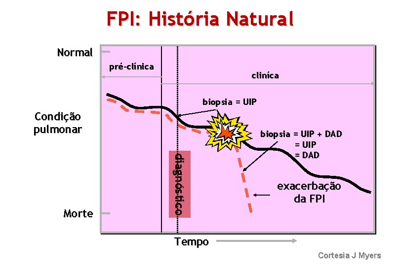 FPI: História Natural Normal pré-clínica cliníca biopsia = UIP Condição pulmonar diagnóstico Morte biopsia