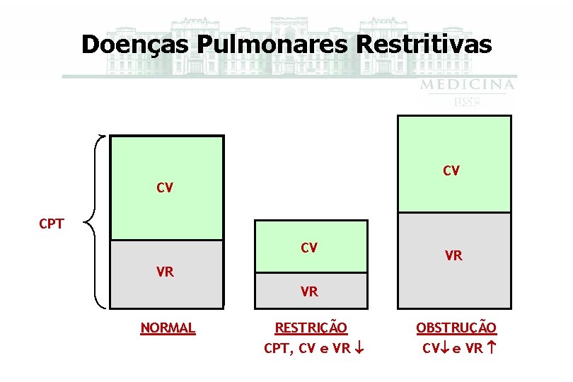 Doenças Pulmonares Restritivas CV CV CPT CV VR VR VR NORMAL RESTRIÇÃO CPT, CV