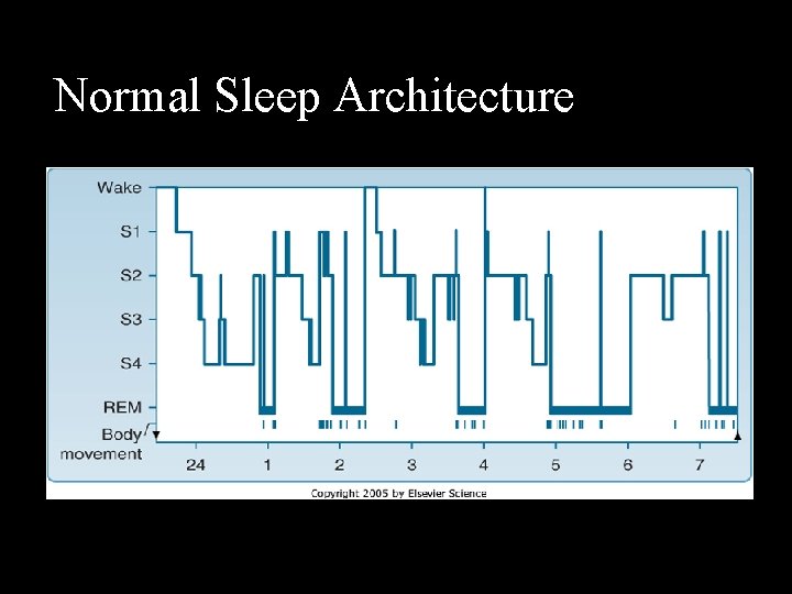 Normal Sleep Architecture 