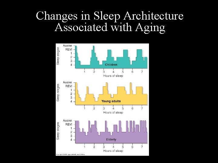 Changes in Sleep Architecture Associated with Aging 