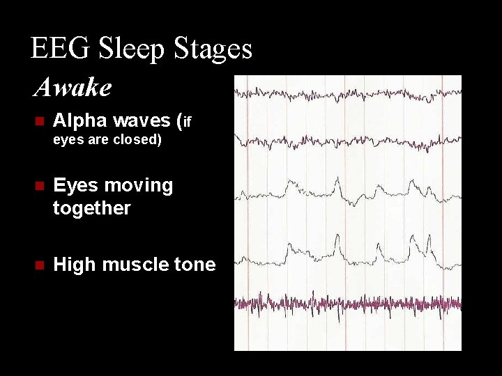 EEG Sleep Stages Awake n Alpha waves (if eyes are closed) n Eyes moving