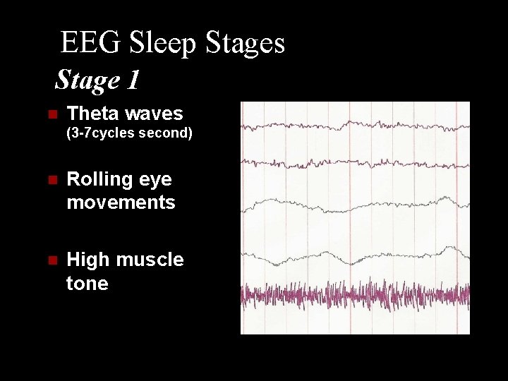 EEG Sleep Stages Stage 1 n Theta waves (3 -7 cycles second) n Rolling