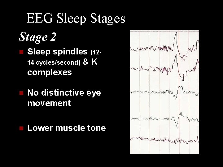 EEG Sleep Stages Stage 2 n Sleep spindles (1214 cycles/second) & K complexes n